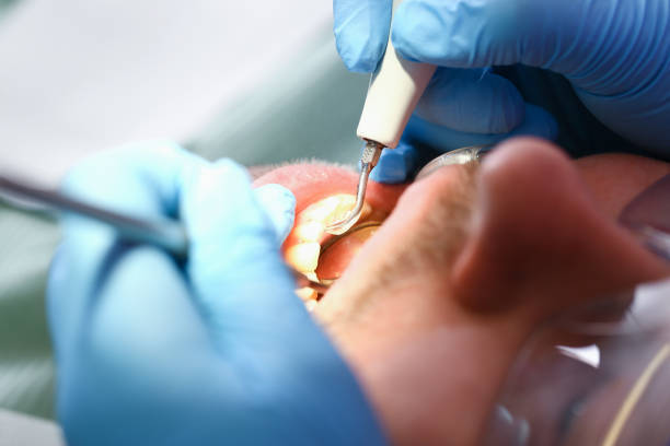 Best Emergency Gum Treatment in Owingsville, KY